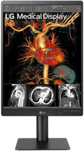 Fotografie LG 21HQ513D  recenzía